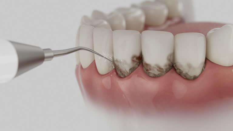 Reliable Dental contractor in Onalaska, TX by Dentist Open Now